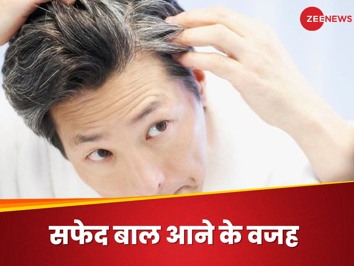 White Hair: बाल सफेद उगने के पीछे इस विटामिन की कमी है जिम्मेदार, बचने के लिए क्या खाएं?