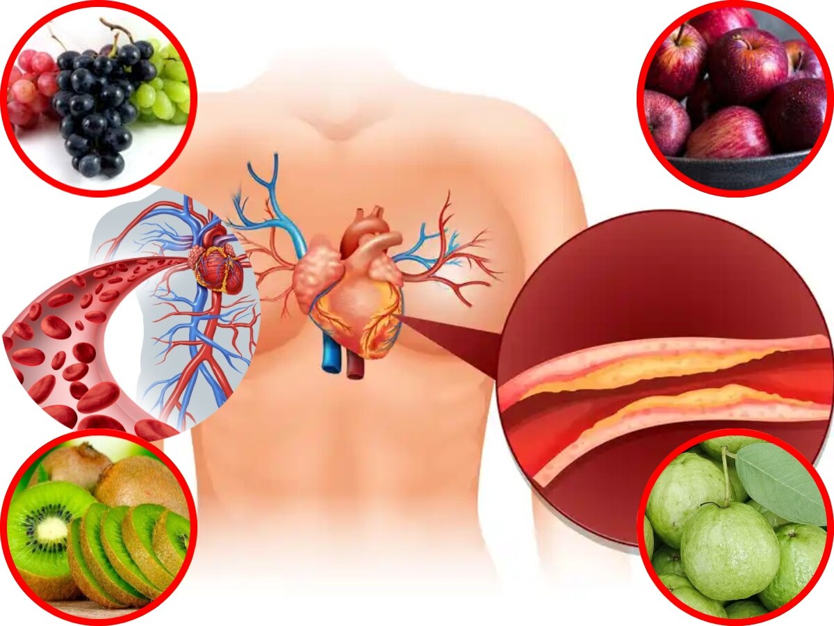 Cholesterol Control Fruits: नसों में जम गया है कोलेस्ट्रॉल, खाएं ये फल, गंदगी को निकाल फेंकेगा बाहर