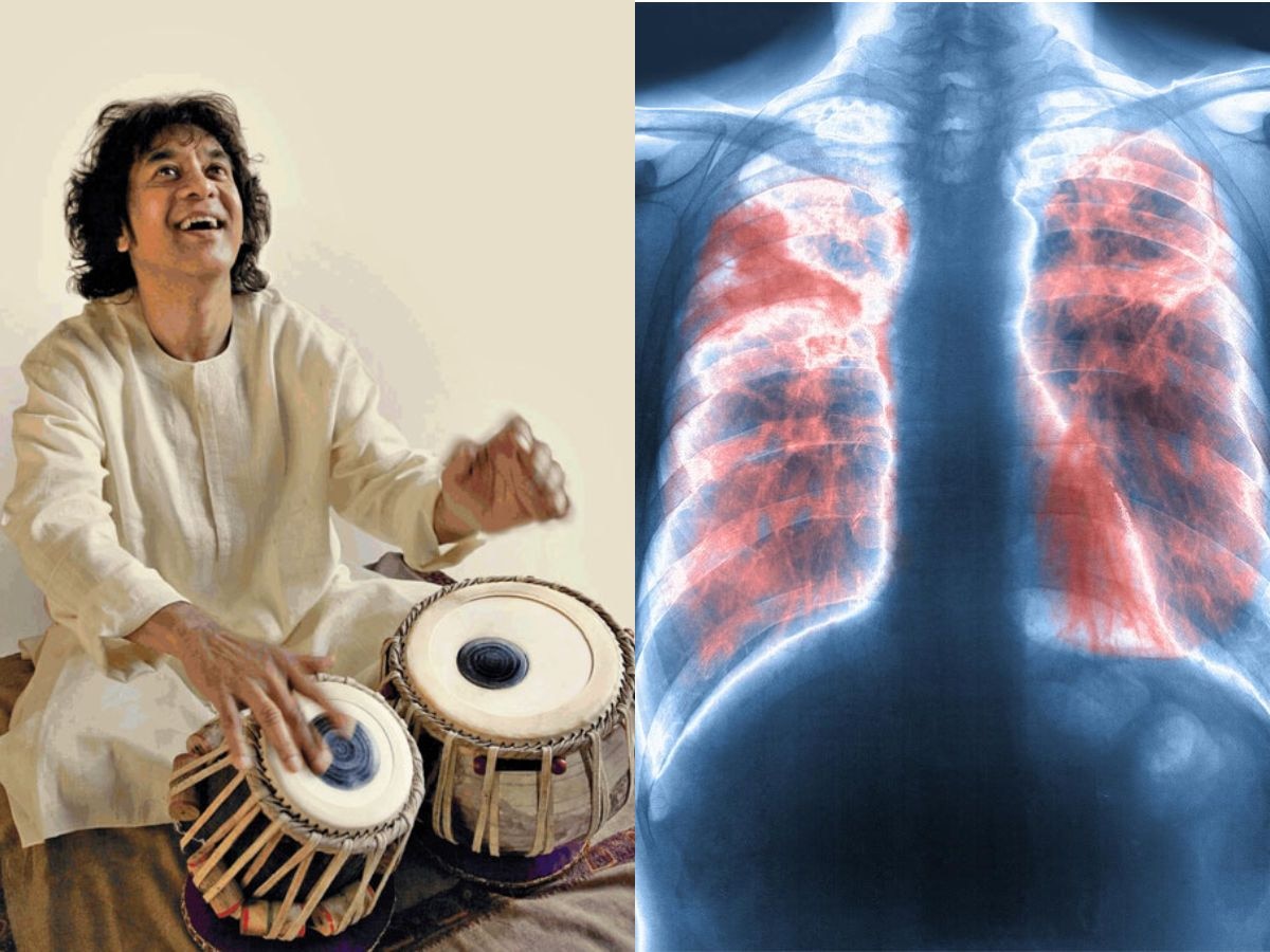 इडियोपैथिक पल्मोनरी फाइब्रोसिस की वजह से हुई Zakir Hussain की मौत, जानें क्या है ये बीमारी?