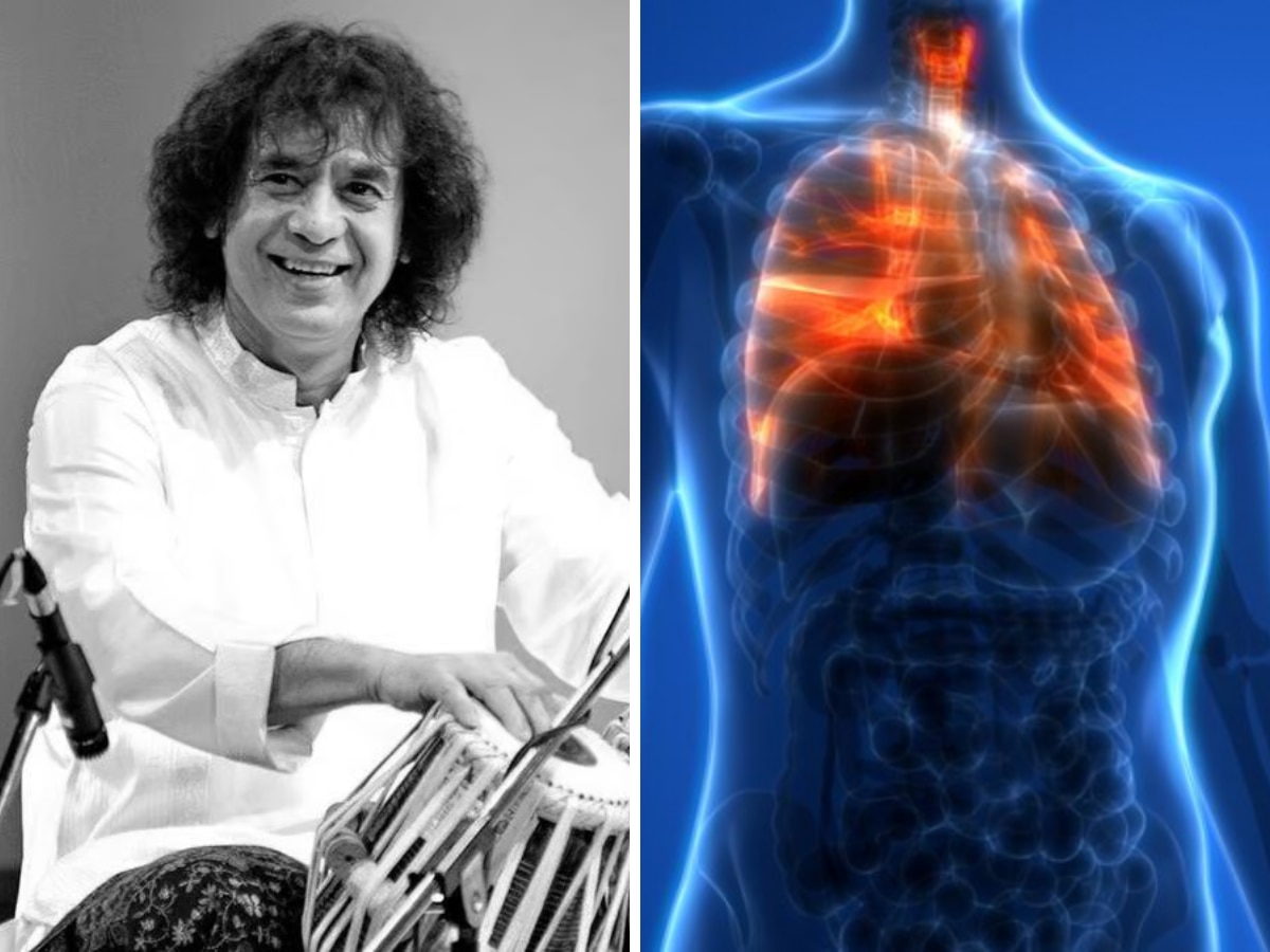 Zakir Hussain को थी फेफड़े का चिथड़ा उड़ा देने वाली ये भयंकर बीमारी, नहीं कोई इलाज, आप तो नहीं रिस्क में? जानें