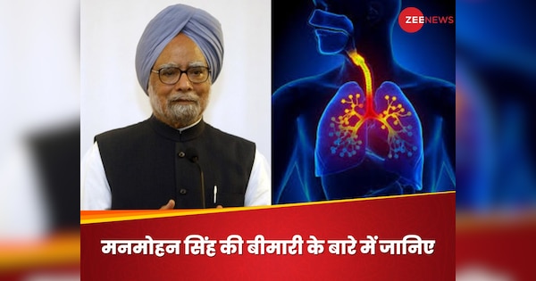 क्या है रेस्पिरेटरी डिजीज, जिससे जिंदगी की जंग हार गए मनमोहन सिंह? कितनी खतरनाक है ये बीमारी