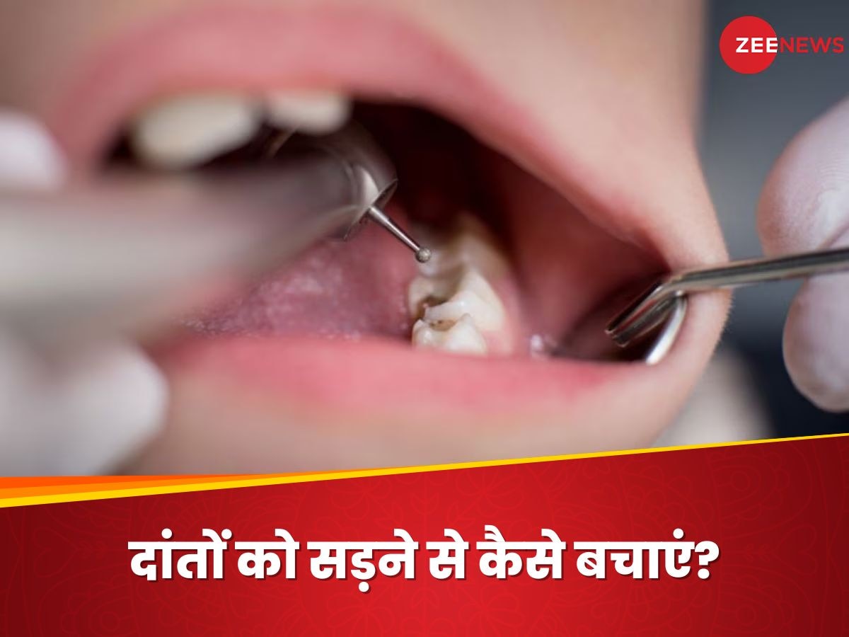 Teeth Cavity: कैविटी की वजह से दांत हो जाएंगे खोखले, तुरंत अपनाएं ये आसान टिप्स