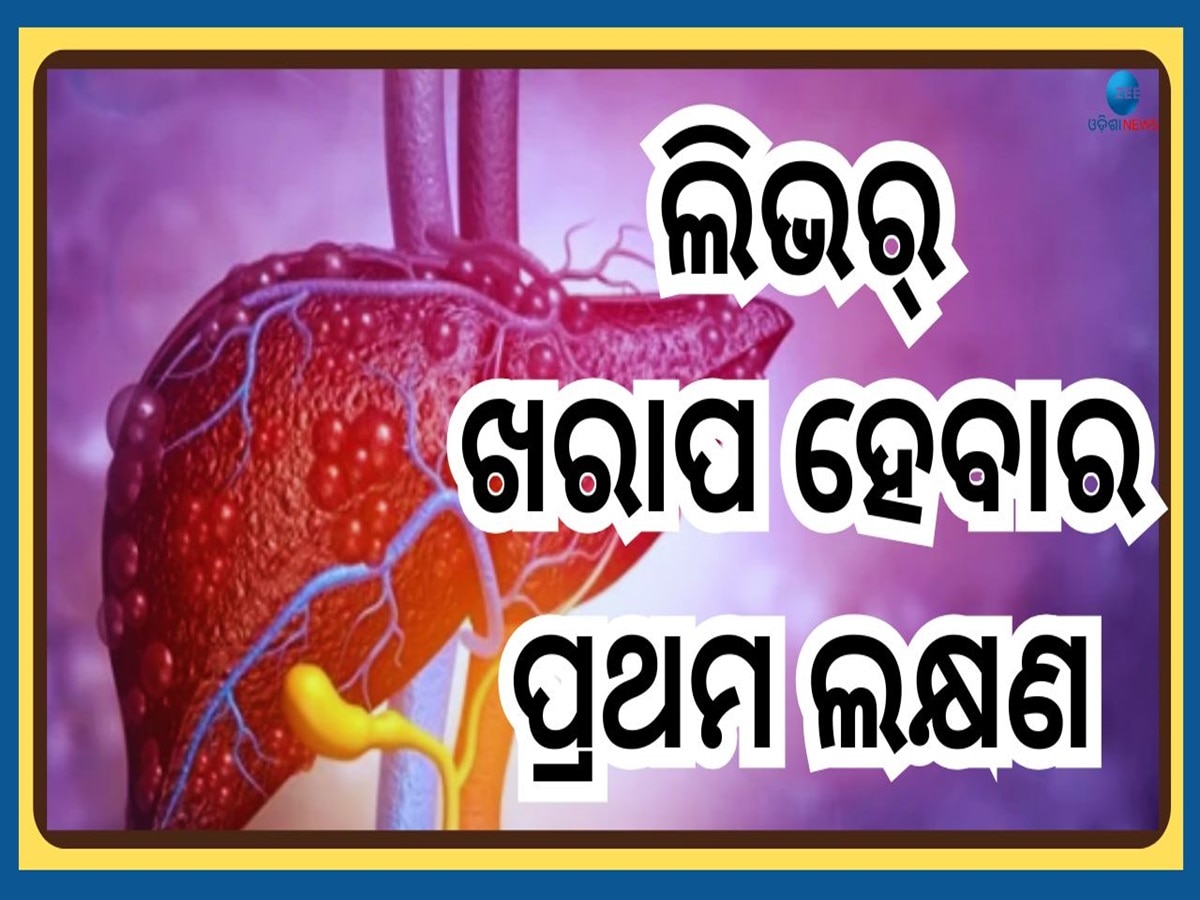 Liver Damage Symptoms: ଲିଭର ଖରାପ ହେବାର ସାଧାରଣ ଲକ୍ଷଣ, କରନ୍ତୁନି ଜମା ବି ଅଣଦେଖା 