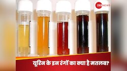 Urine Colour: पीला, हरा, भूरा और लाल, यूरिन के ये 6 रंग बताएंगे आपकी सेहत का हाल