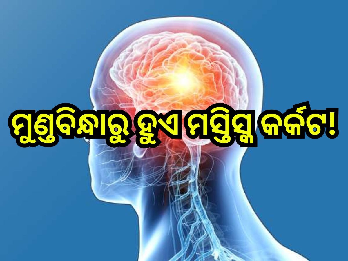 Brain Cancer: ମସ୍ତିସ୍କ କର୍କଟ ହେବା ପୂର୍ବରୁ ଶରୀରରେ ଦେଖାଦିଏ ଏହିସବୁ ଲକ୍ଷଣ