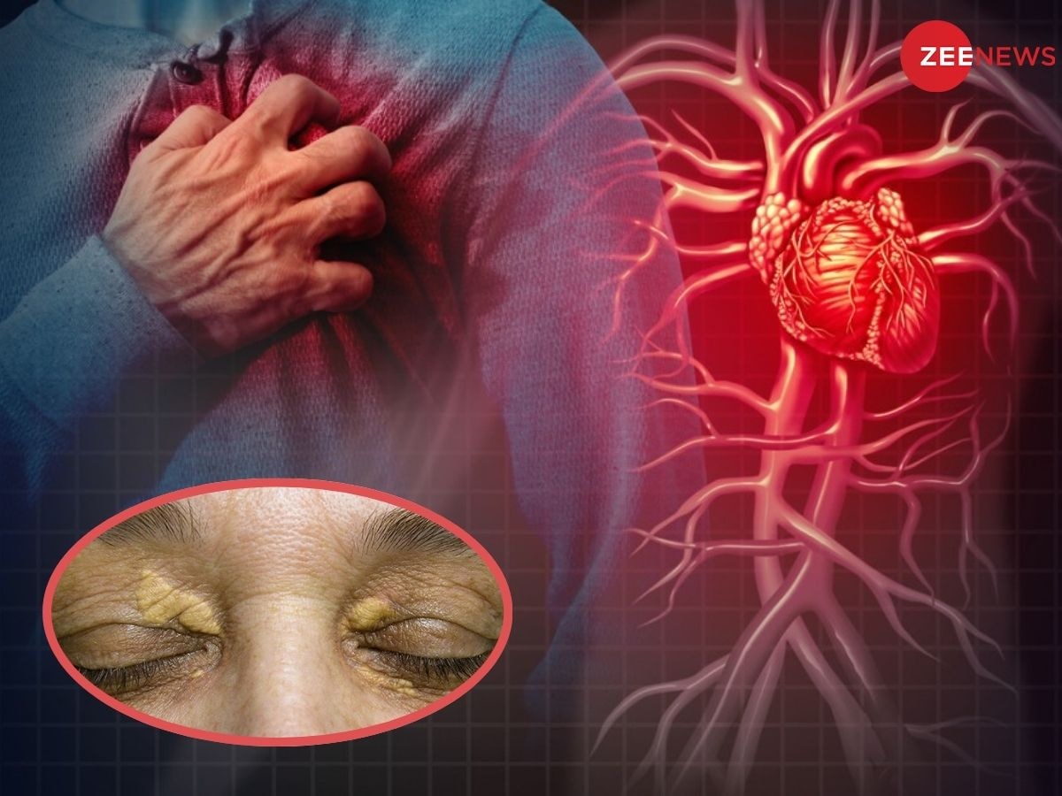 Heart Attack: सीने में दर्द से पहले आंखें करेंगी अलर्ट! हार्ट अटैक के इन 4 चेतावनी संकेतों को मत करना नजरअंदाज