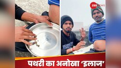 3 साल से झेल रहा था दर्द, झोलाछाप डॉक्टर ने नाभि से निकाले किडनी स्टोन्स