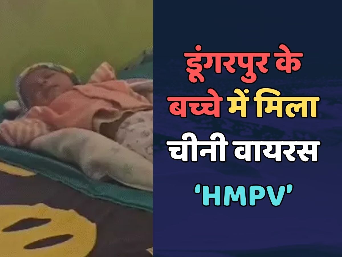 Rajasthan news : Chinese virus HMPV found in a child of Dungarpur in Rajasthan 2 month old child admitted to hospital