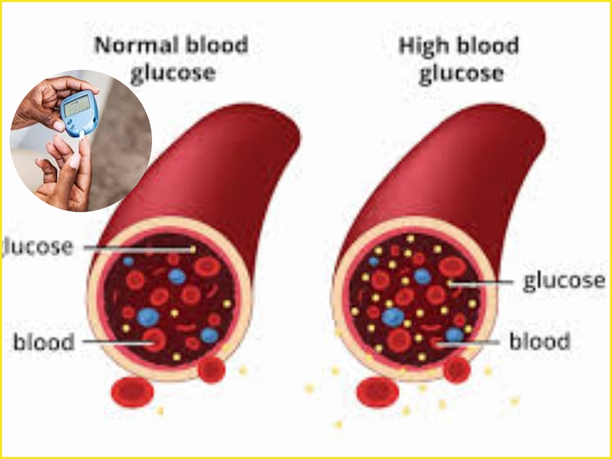 जीना चाहते हैं 100 साल तो इन आदतों को तुरंत कहें बाय बाय, नहीं तो घेर सकता है ब्लड शुगर