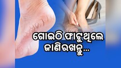 Cracked Heel Remedies: ଗୋଇଠି ଫାଟୁଛି କି ? ଏହି ସହଜ ଉପାୟରେ ପାଆନ୍ତୁ ଆରାମ