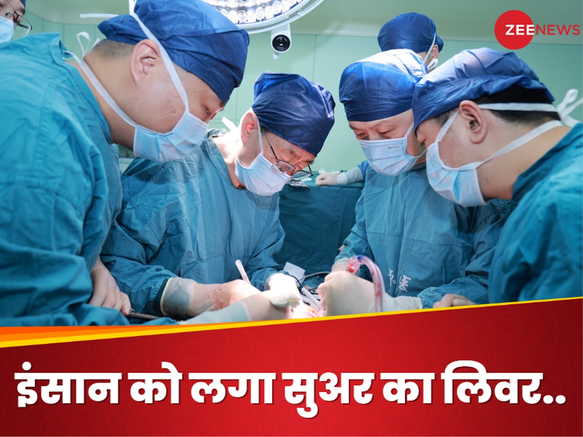 Liver Transplant: ब्रेन डेड मरीज का लिवर हो गया था खराब, डॉक्टरों ने लगा दिया सुअर का लिवर, सर्जरी का रिजल्ट कर देगा हैरान