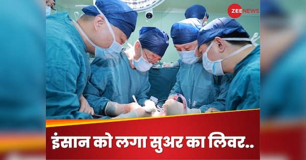 Liver Transplant: ब्रेन डेड मरीज का लिवर हो गया था खराब, डॉक्टरों ने लगा दिया सुअर का लिवर, सर्जरी का रिजल्ट कर देगा हैरान