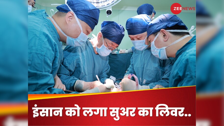 insaan ko lagaya pig ka liver, doctors implanted pigs liver to brain ...