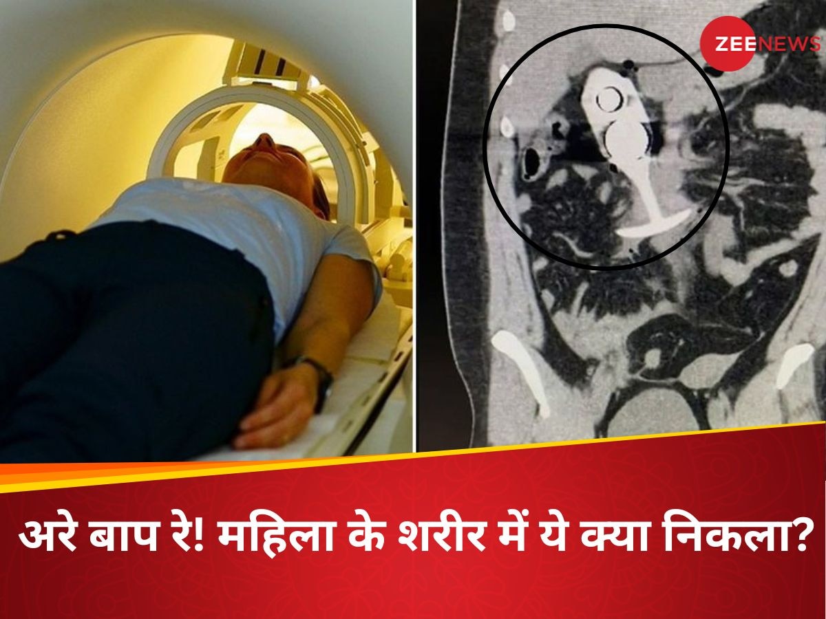 तेज दर्द से टूट रहा था शरीर, महिला का MRI देख डॉक्टरों के उड़े होश, फिर यूं बचाई जान