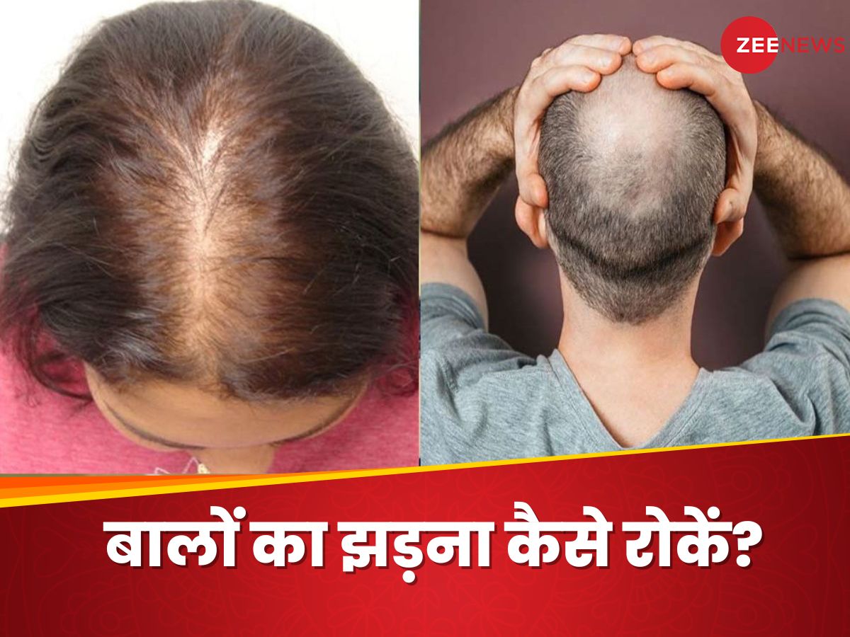 Hair Fall Problem How to overcome Baldness Home Remedies Ganjapan Pyaaz ...