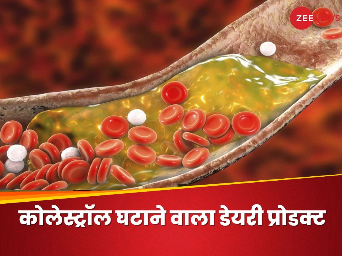 Cholesterol: इस टेस्टी डेयरी प्रोडक्ट के सेवन से घटेगा बैड कोलेस्ट्रॉल, फुर्र होगी हार्ट अटैक की फिक्र