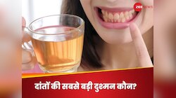 चाय-कॉफी, कोल्ड ड्रिंक या रेड वाइन, किसे पीने से दांत होते हैं ज्यादा दागदार?