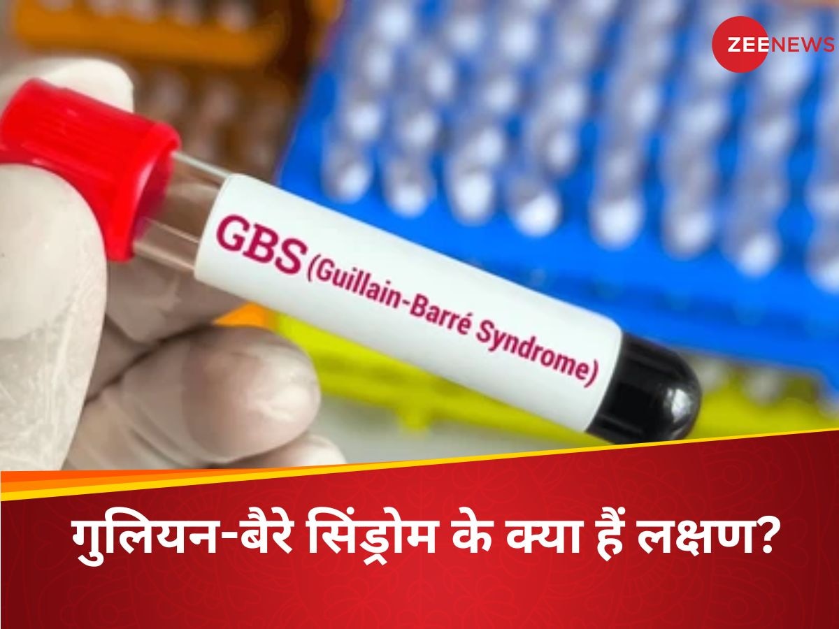 Guillain Barre Syndrome Pune: क्या है गुलियन-बैरे सिंड्रोम? भारत के इस शहर में फैली ऐसी बीमारी, स्‍वास्‍थ्‍य विभाग के फूल गए हाथ-पांव