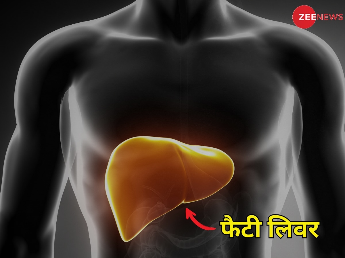 Fatty Liver के इन 5 लक्षणों को न करें नजरअंदाज, घर बैठे इस तरह पहचानें