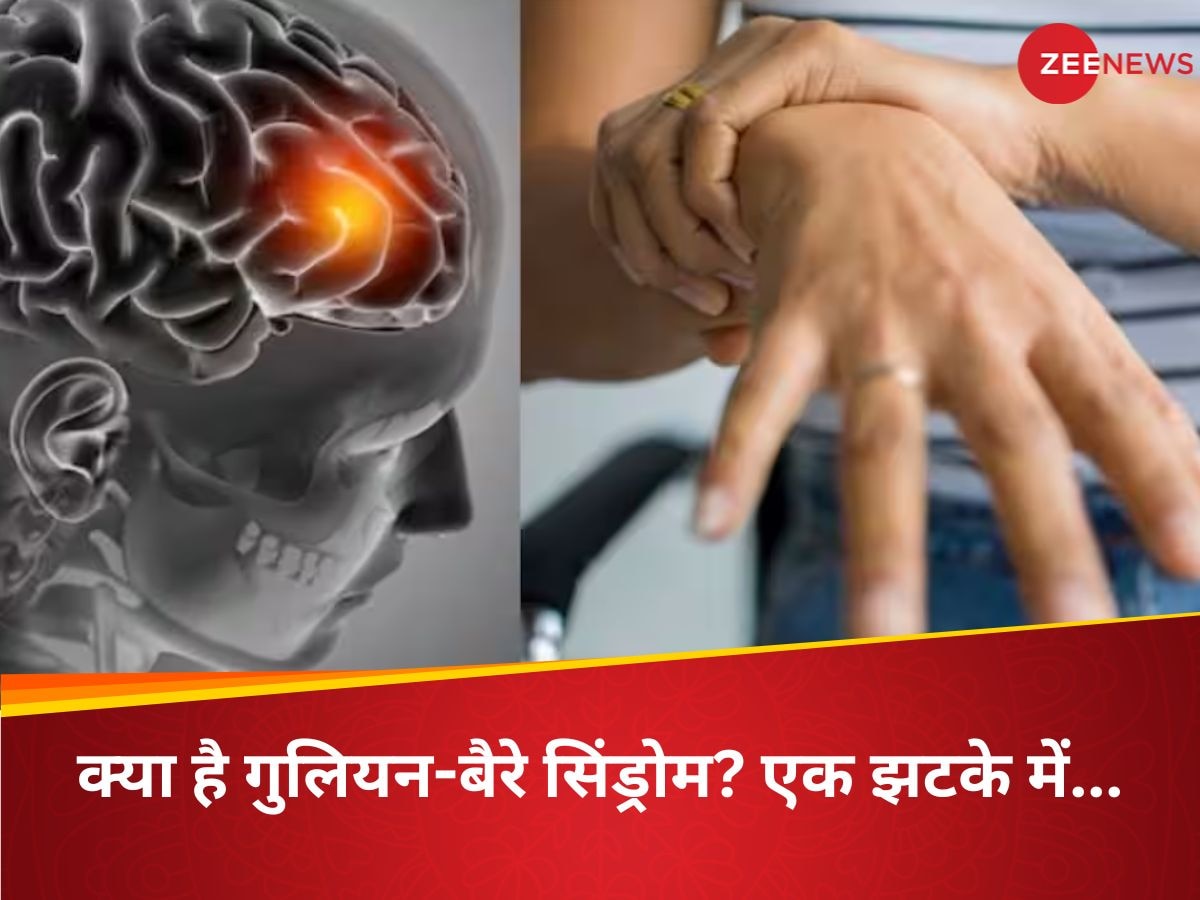 गुलियन-बैरे सिंड्रोम से पहली मौत; 16 मरीज वेंटिलेटर पर, डॉक्टर से लेकर मरीज तक हर कोई हैरान, महाराष्ट्र में मचा हाहाकार