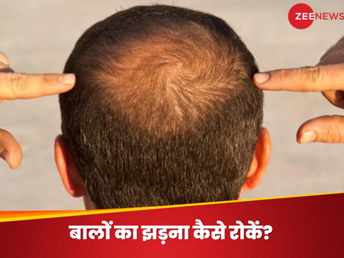 Hair Care Tips: लगातार झड़ते बालों से साफ दिखने लगी है खोपड़ी? सिर पर लगाना शुरू कर दें यह एक चीज, होगा बहुत फायदा