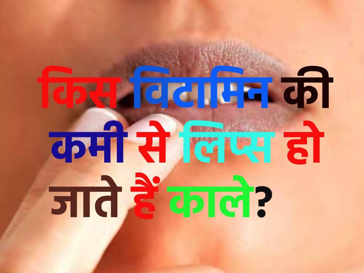 Trending Quiz: क्या आपको पता है, किस विटामिन की कमी से होंठ काले होते हैं?