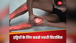 हड्डियों का दर्द हो गया हद से पार, कहीं इस विटामिन की कमी तो नहीं?