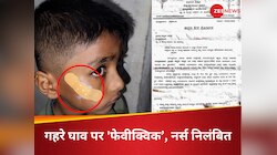 गाल में गहरा घाव, नर्स ने टांके की जगह लगा दिया 'फेवीक्विक', मचा हड़कंप