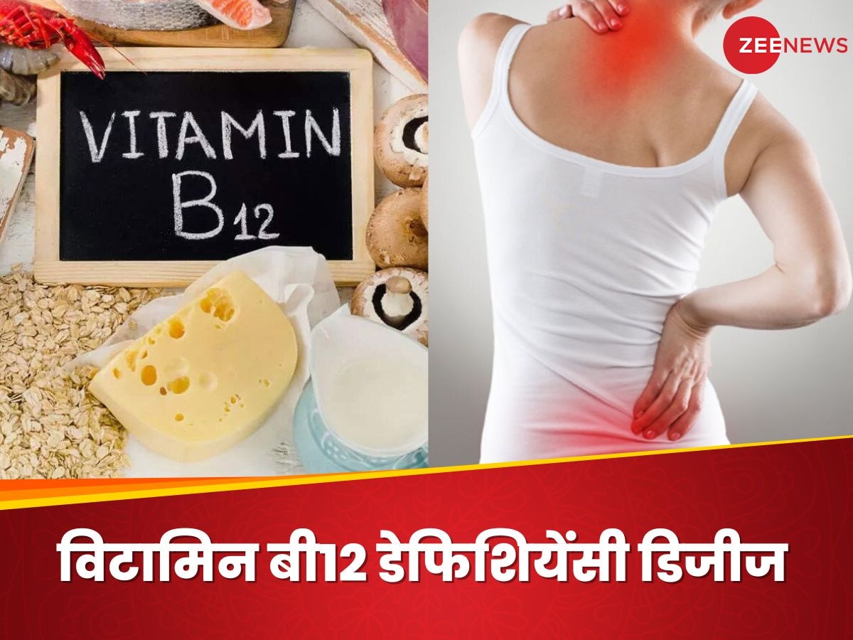 Vitamin B12: खून का कतरा-कतरा चूस लेगी विटामिन बी12 की कमी, टूट जाएगा शरीर!