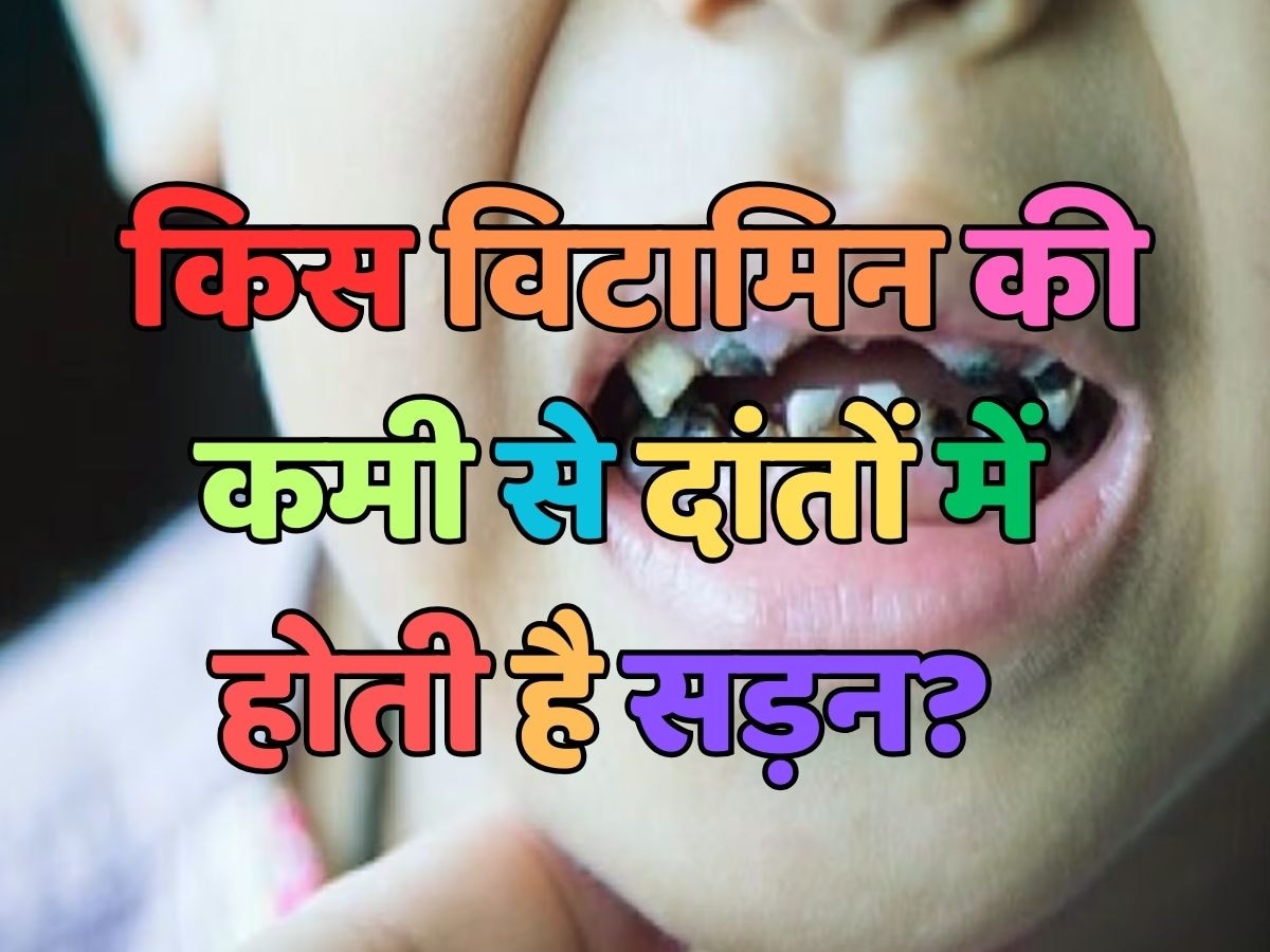 Health Quiz: किस विटामिन की कमी से दांतों में कीड़े लगते हैं? 