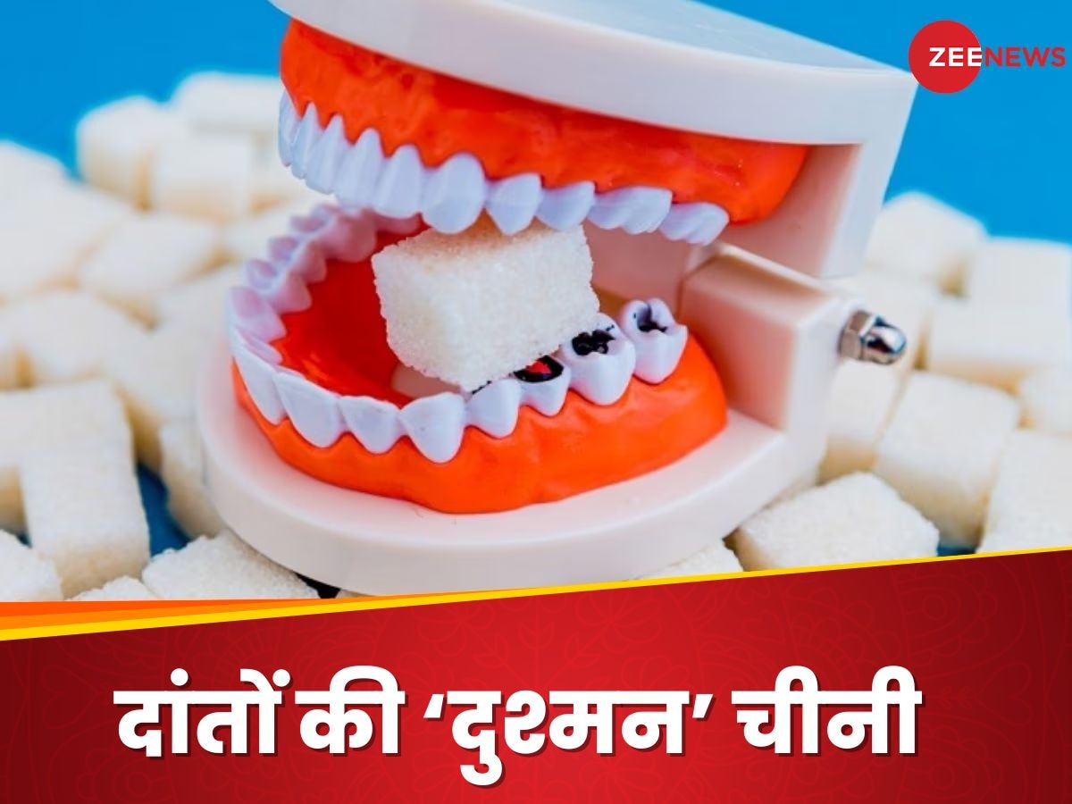 Teeth: दांतों के लिए 'काल' क्यों बन जाती है चीनी? कर देती है ओरल हेल्थ का कबाड़ा