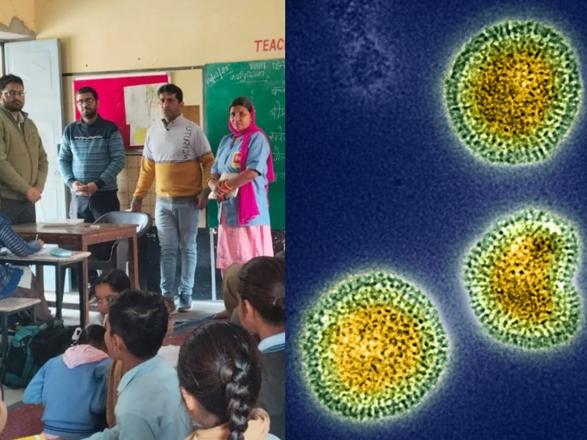 Rajasthan New Disease: राजस्थान में नए वायरस का बरपा कहर,  3 बच्चों की मौत, 20 का चल रहा इलाज