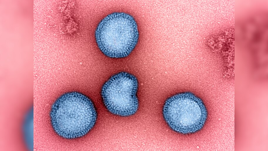 Influenza- B Virus: रजौरी की तरह हनुमानगढ़ में भी रहस्यमय बीमारी ने दी दस्तक, जिंदगी और मौत के बीच संघर्ष कर रहे कई मासूम
