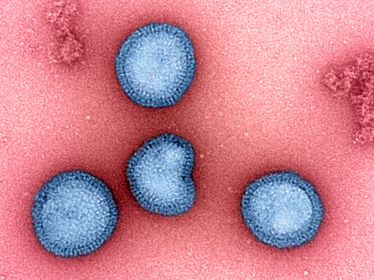 Influenza- B Virus: रजौरी की तरह हनुमानगढ़ में भी रहस्यमय बीमारी ने दी दस्तक, जिंदगी और मौत के बीच संघर्ष कर रहे कई मासूम Influenza- B Virus: रजौरी की तरह हनुमानगढ़ में भी रहस्यमय बीमारी ने दी दस्तक, जिंदगी और मौत के बीच संघर्ष कर रहे कई मासूम