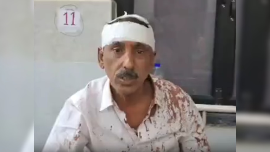 Alwar News: शादी का कार्ड नहीं मिलने पर आग बबूला हुआ समधी, गुस्से में फोड़ा बहु के पिता का सिर