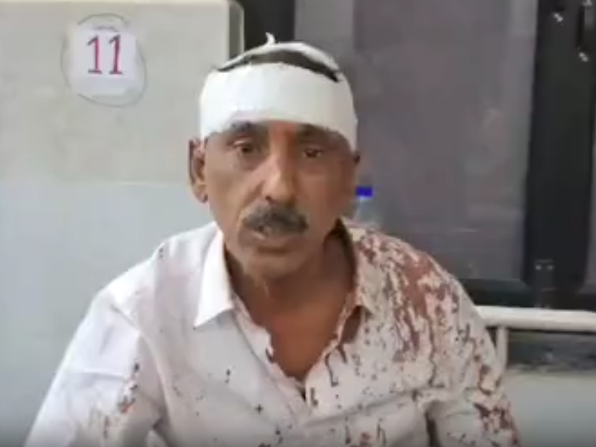Alwar News: शादी का कार्ड नहीं मिलने पर आग बबूला हुआ समधी, गुस्से में फोड़ा बहु के पिता का सिर Alwar News: शादी का कार्ड नहीं मिलने पर आग बबूला हुआ समधी, गुस्से में फोड़ा बहु के पिता का सिर