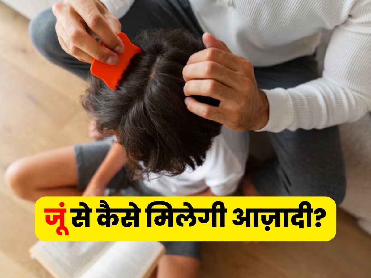 बालों में जूं कर रही परेशान? खुजलाएं नहीं, ऐसे मिटाएं अनचाहे मेहमानों का नामोनिशान