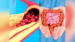 नसों से कटकर बाहर आएगा कोलेस्ट्रॉल, बस सुबह खाली पेट खा लें ये मसाला 