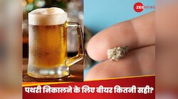 क्या बीयर पीने से वाकई निकल जाती है पथरी या ट्रिगर कर जाती है बीमारी? जान लें फैक्ट