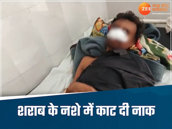 होली पर साथ बैठकर पी रहे थे शराब, अचानक उठे दो दोस्त और काट दी तीसरे की नाक, जानिए क्या है कहानी