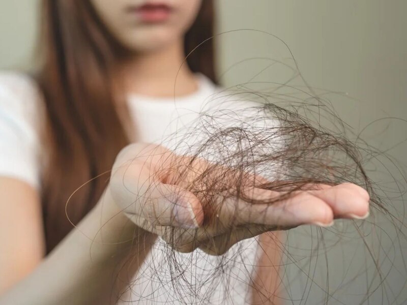 हेयर फॉल 