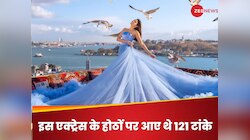 इस एक्ट्रेस को कुत्ते ने होंठ पर काटा, लगे 120 टांके, एक हादसे ने बदल दी थी जिंदगी!