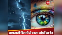 OMG! आसमानी बिजली से बदल गई महिला की आंखों का रंग, ऐसा नजारा देख वैज्ञानिक रह गए दंग