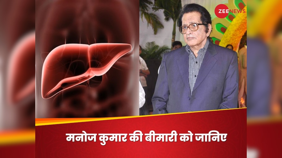 Decompensated Liver Cirrhosis: जिस बीमारी से हुआ एक्टर मनोज कुमार का निधन, उस डिजीज के बारे में जानिए