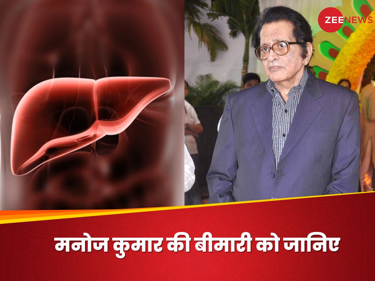 Decompensated Liver Cirrhosis: जिस बीमारी से हुआ एक्टर मनोज कुमार का निधन, उस डिजीज के बारे में जानिए Decompensated Liver Cirrhosis: जिस बीमारी से हुआ एक्टर मनोज कुमार का निधन, उस डिजीज के बारे में जानिए