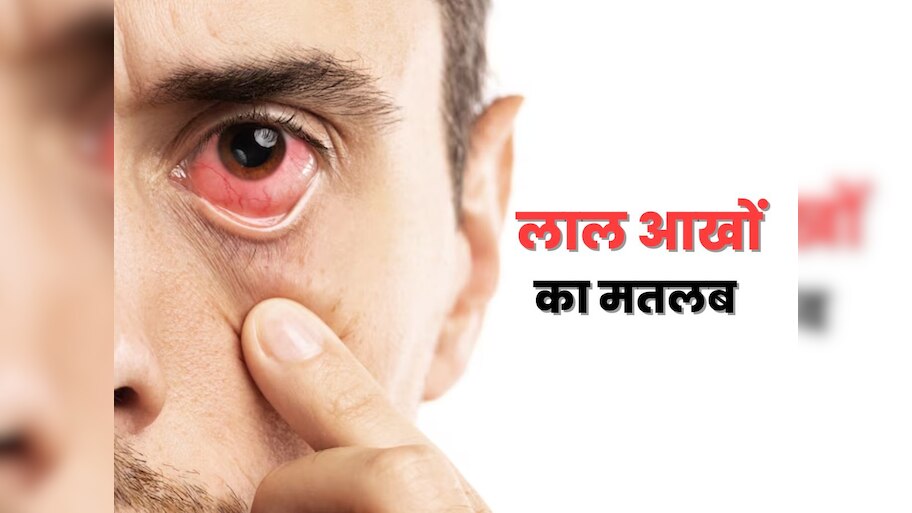What Red Eyes in The Morning Indicates Warning Signs For Disease Laal ...