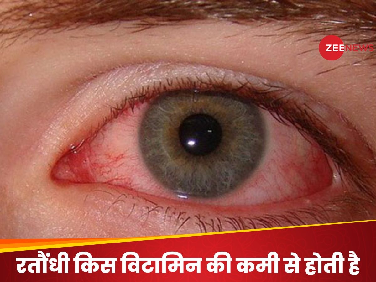इस विटामिन की कमी से होता है रात का अंधापन! ढलते सूरज के साथ कम होने लगे दिखना तो ना करें इग्नोर