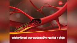 कोलेस्ट्रॉल कम कर सकते हैं ये 5 सुपर फूड्स, नसों में फैट नहीं; पंप करेगा खून!