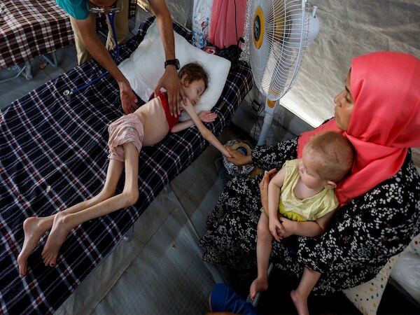 Gaza News: खाने से तरसा रहा इजराइल, एक महीने में 3,696 फिलिस्तीनी बच्चे कुपोषण का शिकार