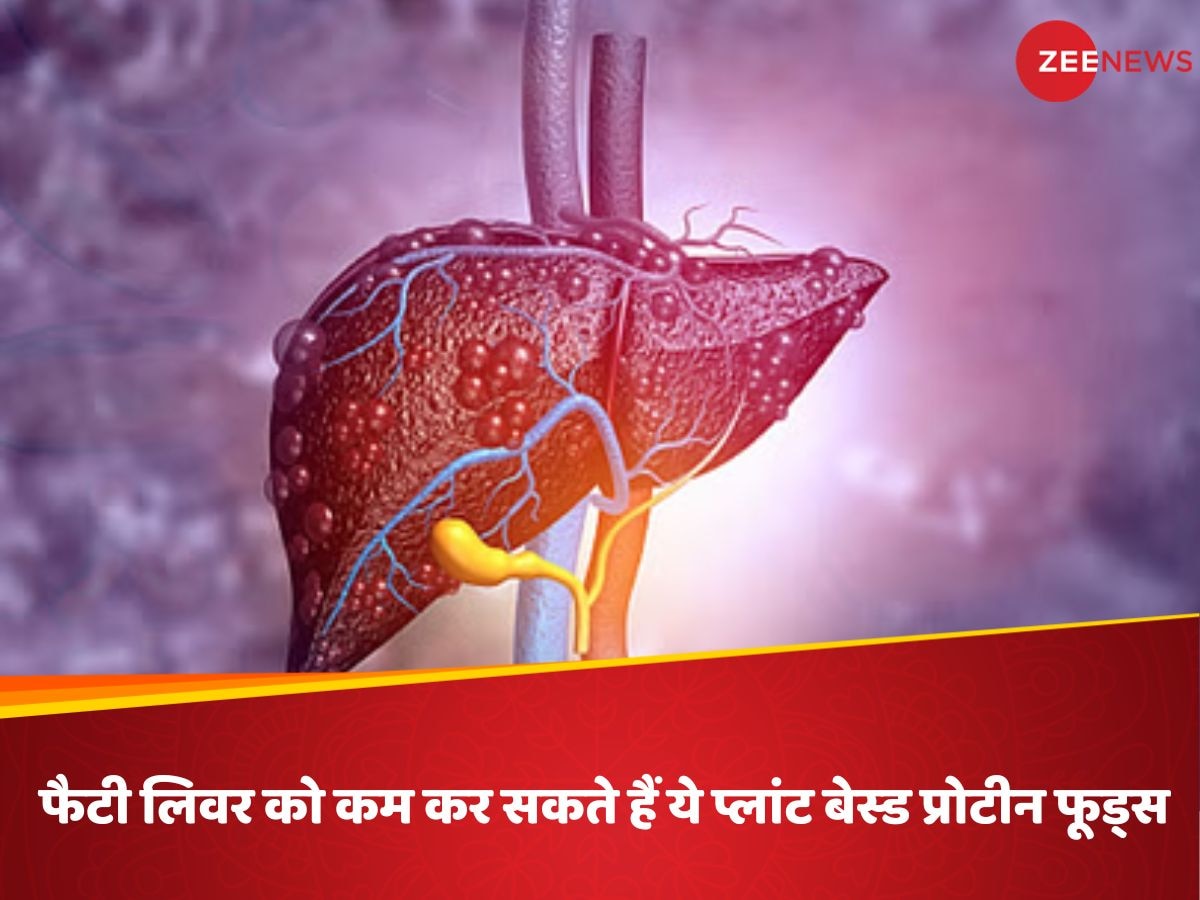 फैटी लिवर को कम कर सकते हैं ये प्लांट बेस्ड प्रोटीन फूड्स, कलेजा होगा साफ! रिसर्च में हुआ खुलासा
